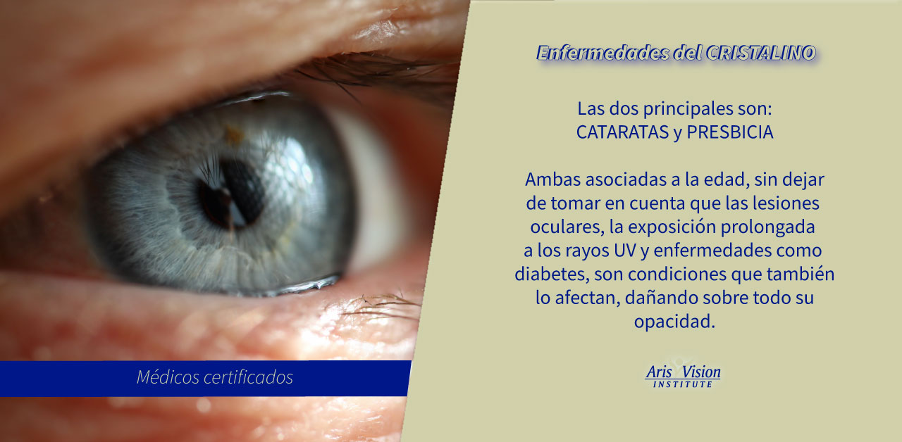 #enfermedadesdelosojos 👀 👉El cristalino... - Aris Vision CDMX | Facebook