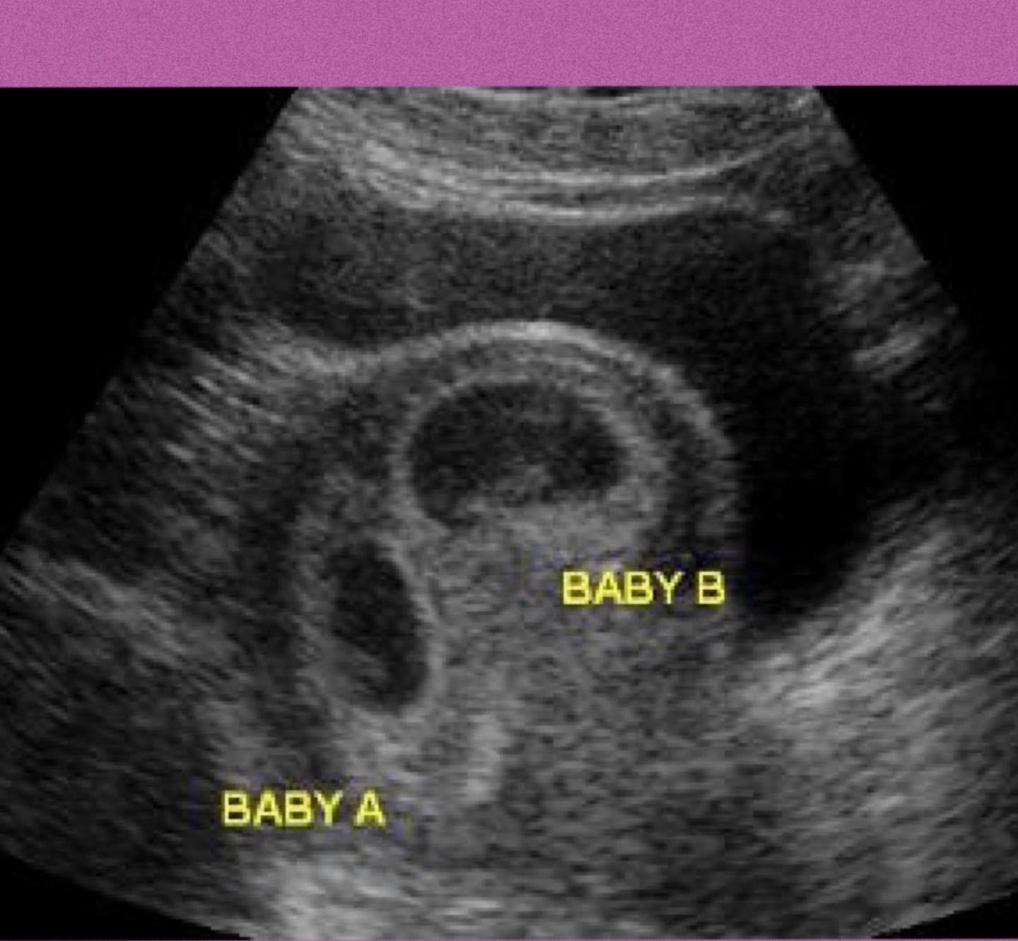 Did somebody... - First Encounters Ultrasound Cardiff Gate