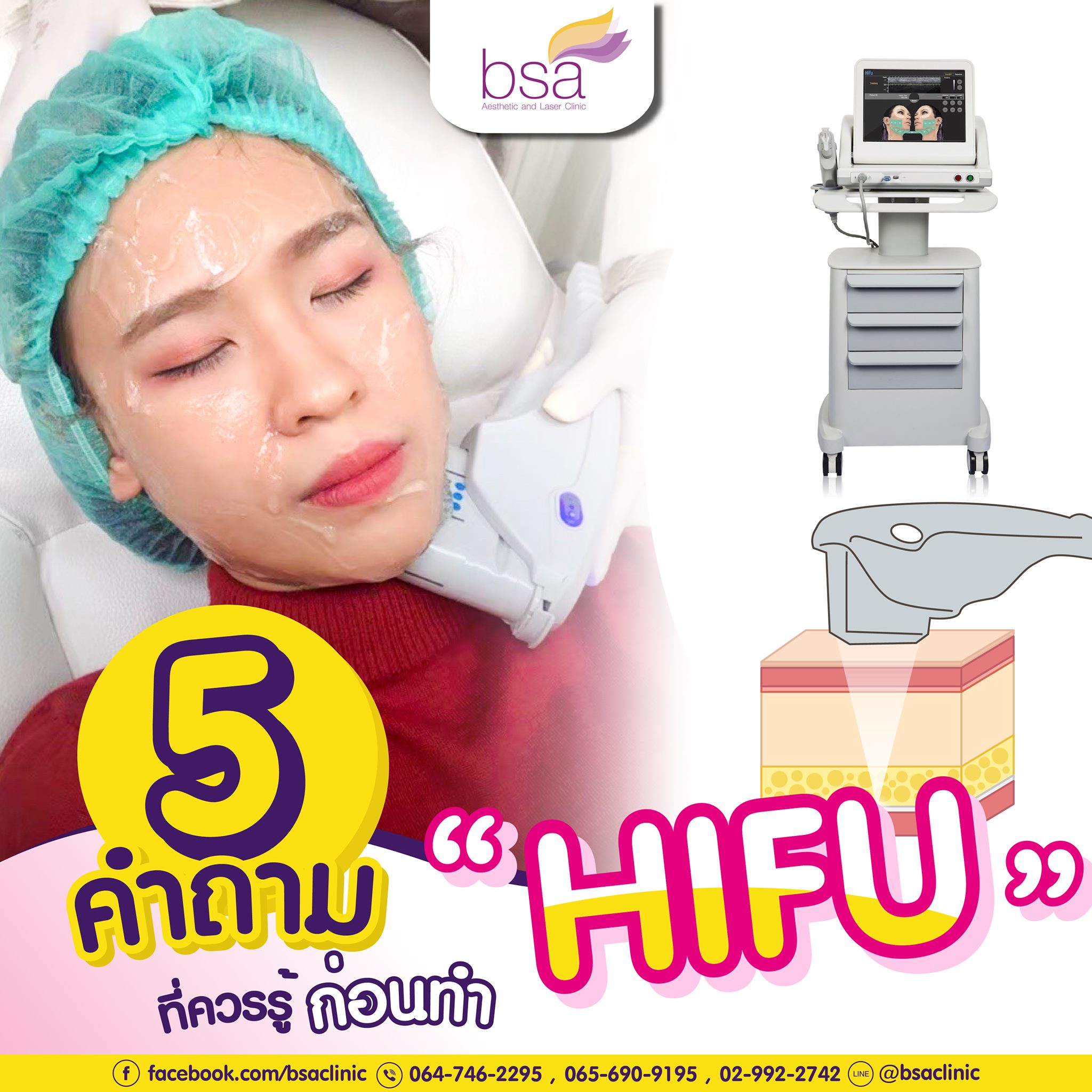 BSA Clinic - 👉 5 คำถามที่ควรรู้ก่อนทำ " HIFU " 📍 1.Hifu...