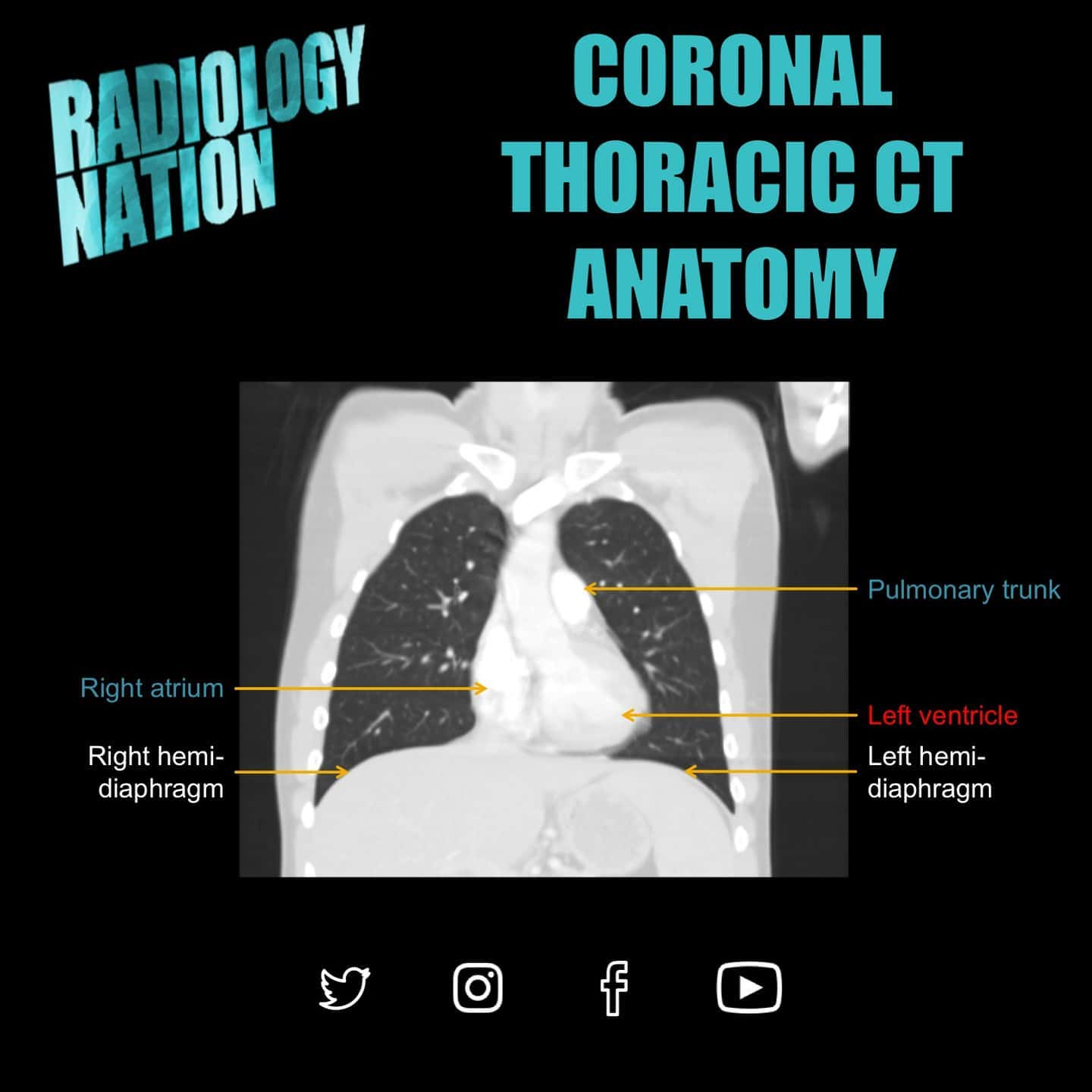 🎉 Here is a series of anatomy slides... - Radiology Nation