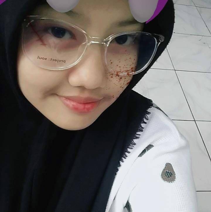 Melmel