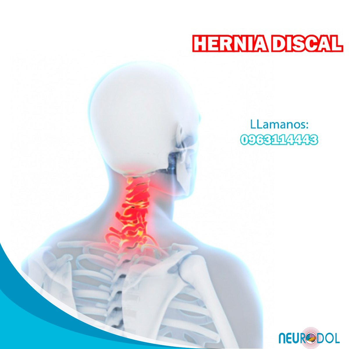 Neurodol - 👩‍⚕️Si tu hernia de disco está en el cuello,...