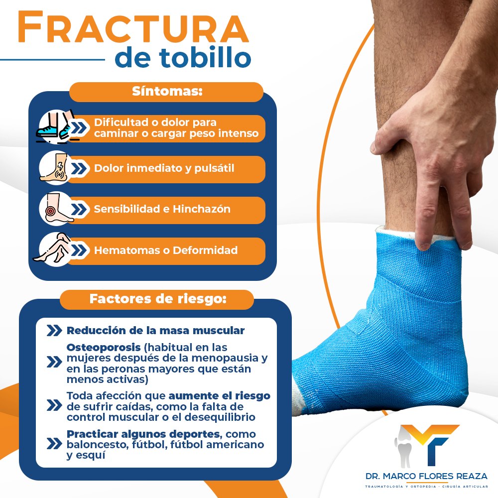 🦵💥Las fracturas de tobillo son lesiones comunes y pueden involucrar ...