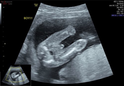 Scan Jantina Baby Poliklinik Nusantara Kota Marudu 16 Jam فیس بوک