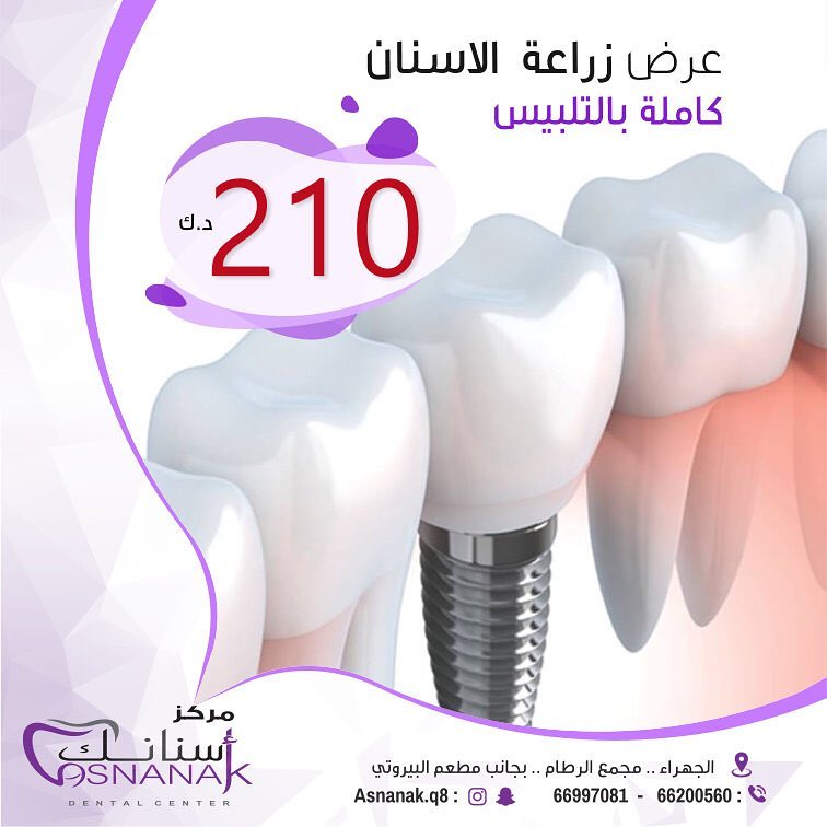 مركز أسنانك لطب الأسنان حياكم في مركز أسنانك لطب الأسنان الجهراء عرض زراعة الأسنان كاملة بالتلبيس فقط بسعر 210 دينار كويتي زيارتكم تهمنا حياكم