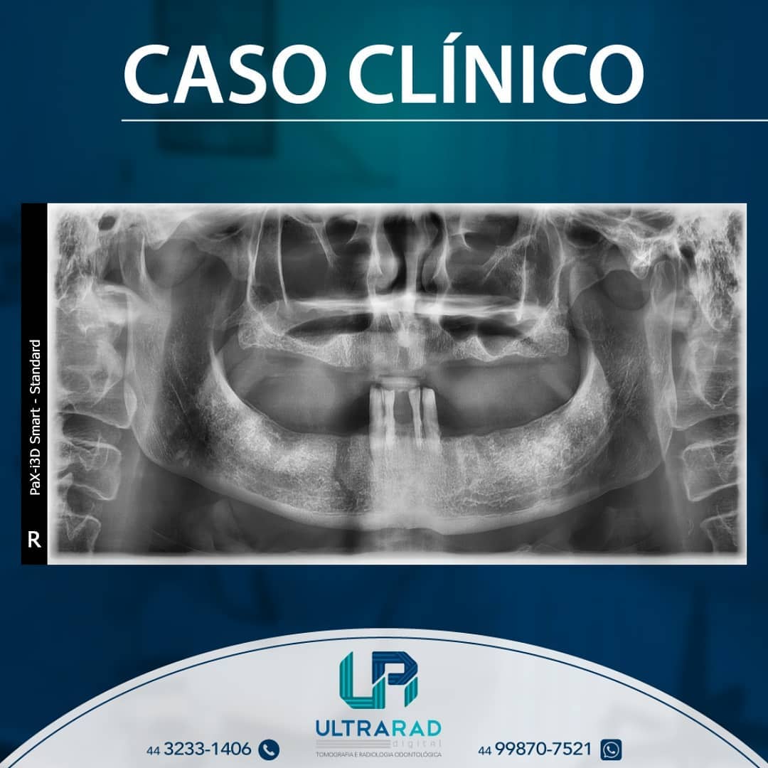 🗣️... - Ultrarad - Radiologia Odontológica Digital