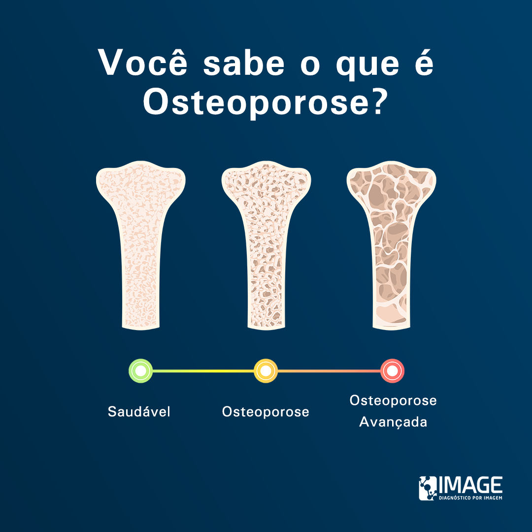 Caracterizada pela perda... - Image Diagnóstico por Imagem | Facebook