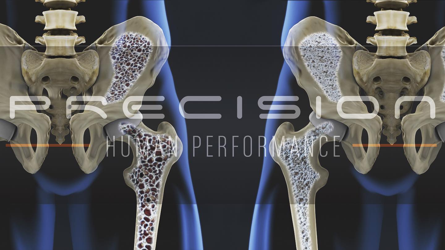 BONE DENSITY...You, your... - Precision Human Performance | Facebook