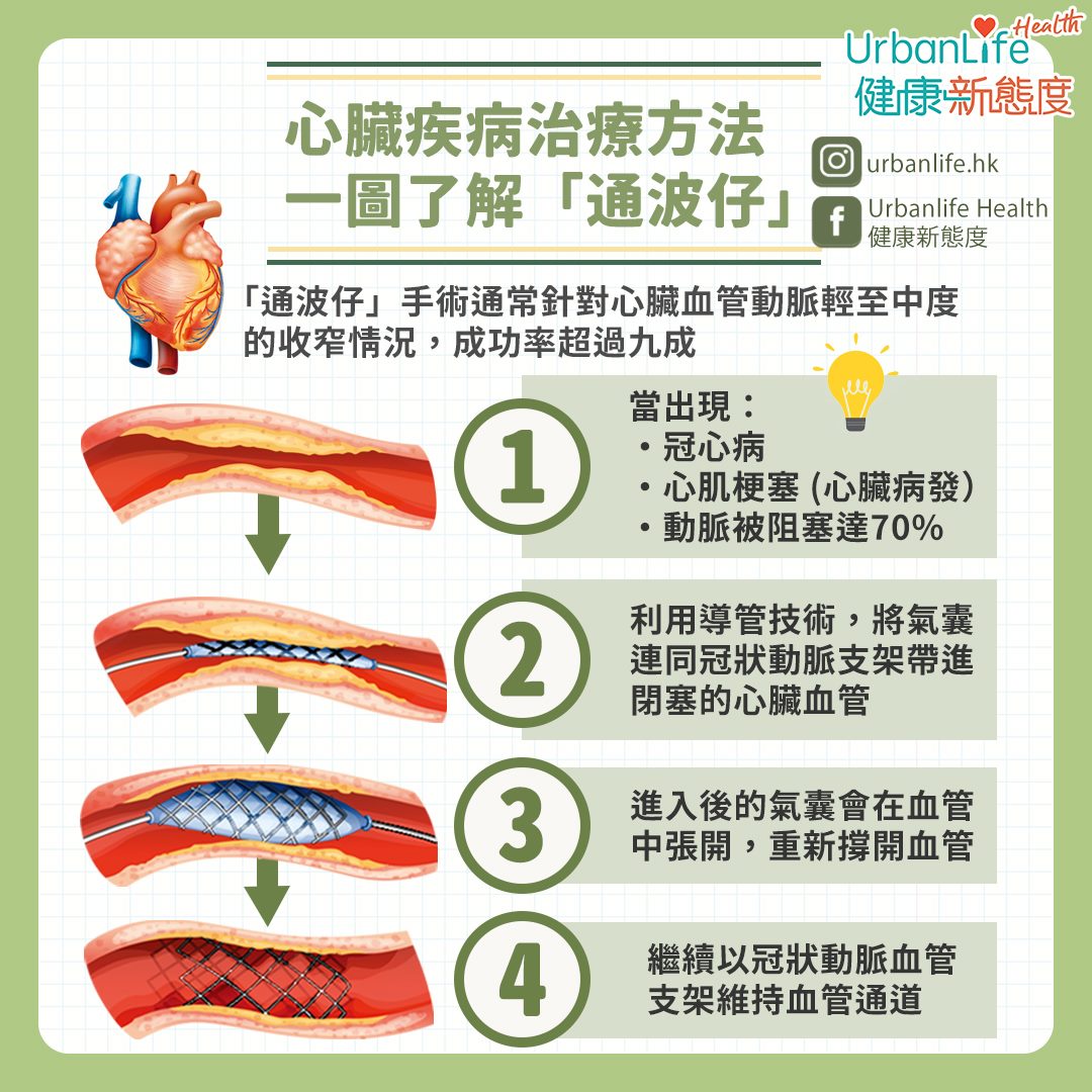 【#UL醫學專科】心臟疾病治療方法 一圖了解「通波仔」... - UrbanLife Health 健康新態度 | Facebook