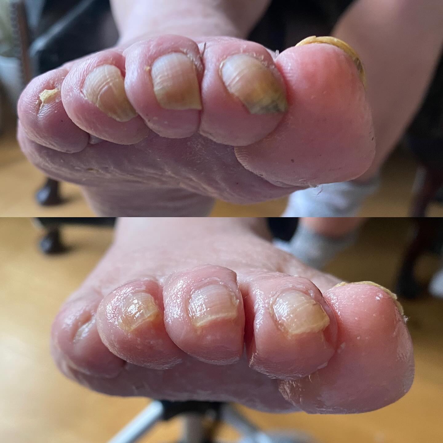 Step Forward - Grace's Mobile Foot Health Clinic | Nottingham