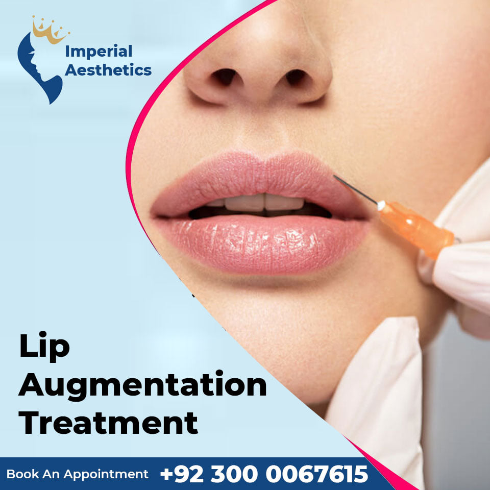 Imperial Aesthetics Gujrat - Lip Augmentation Treatment Lip ...
