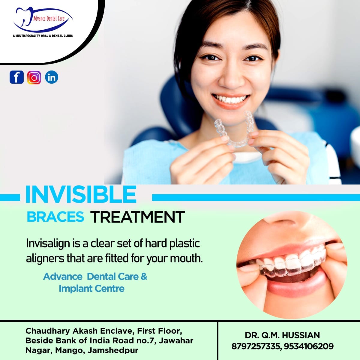 Advance - Invisible brace treatment is Invisalign is a clear set of ...