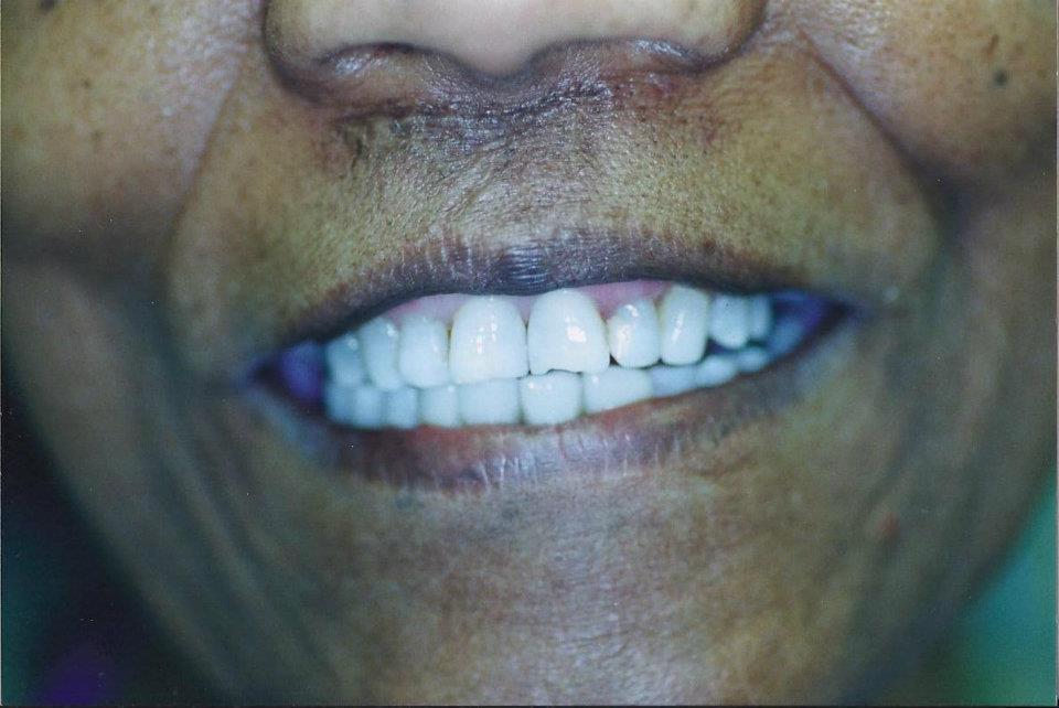 Arbor Dental Pennsauken NJ