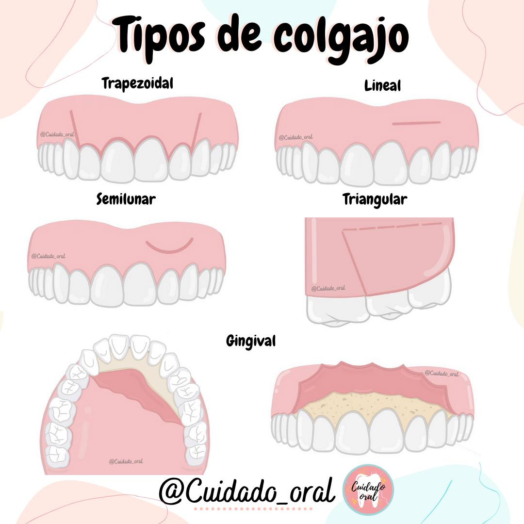 Incisiones y Colgajos en Cirugía Bucal - Odontologos.com.co | Facebook