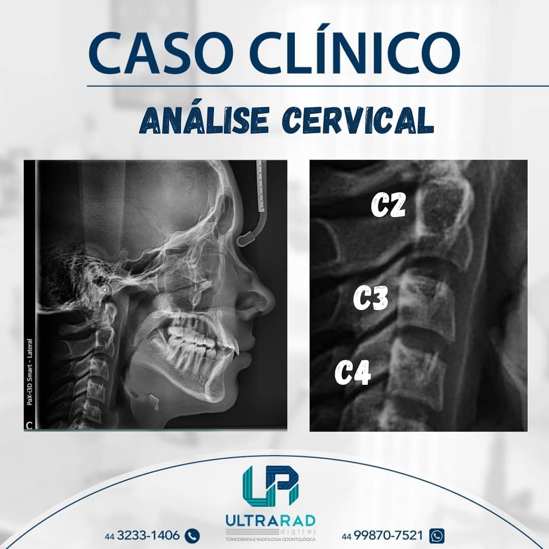 🔷 ANÁLISE... - Ultrarad - Radiologia Odontológica Digital