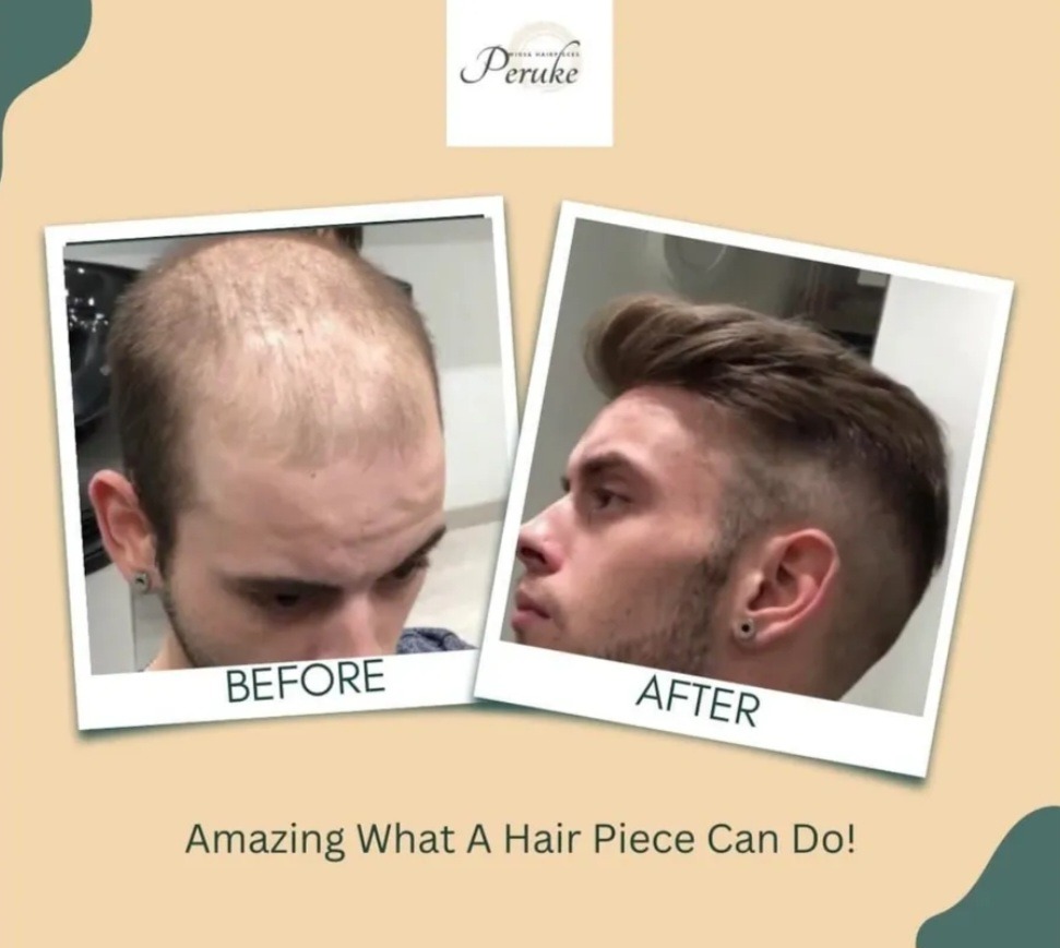 Peruke Wigs - Here are just a few of the tangible results...