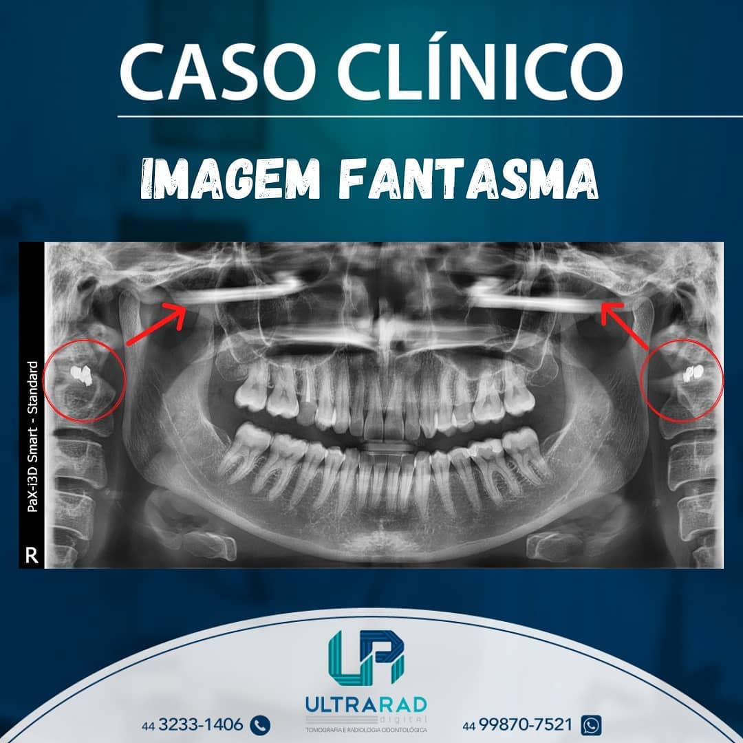 🗣️ IMAGENS... - Ultrarad - Radiologia Odontológica Digital | Facebook