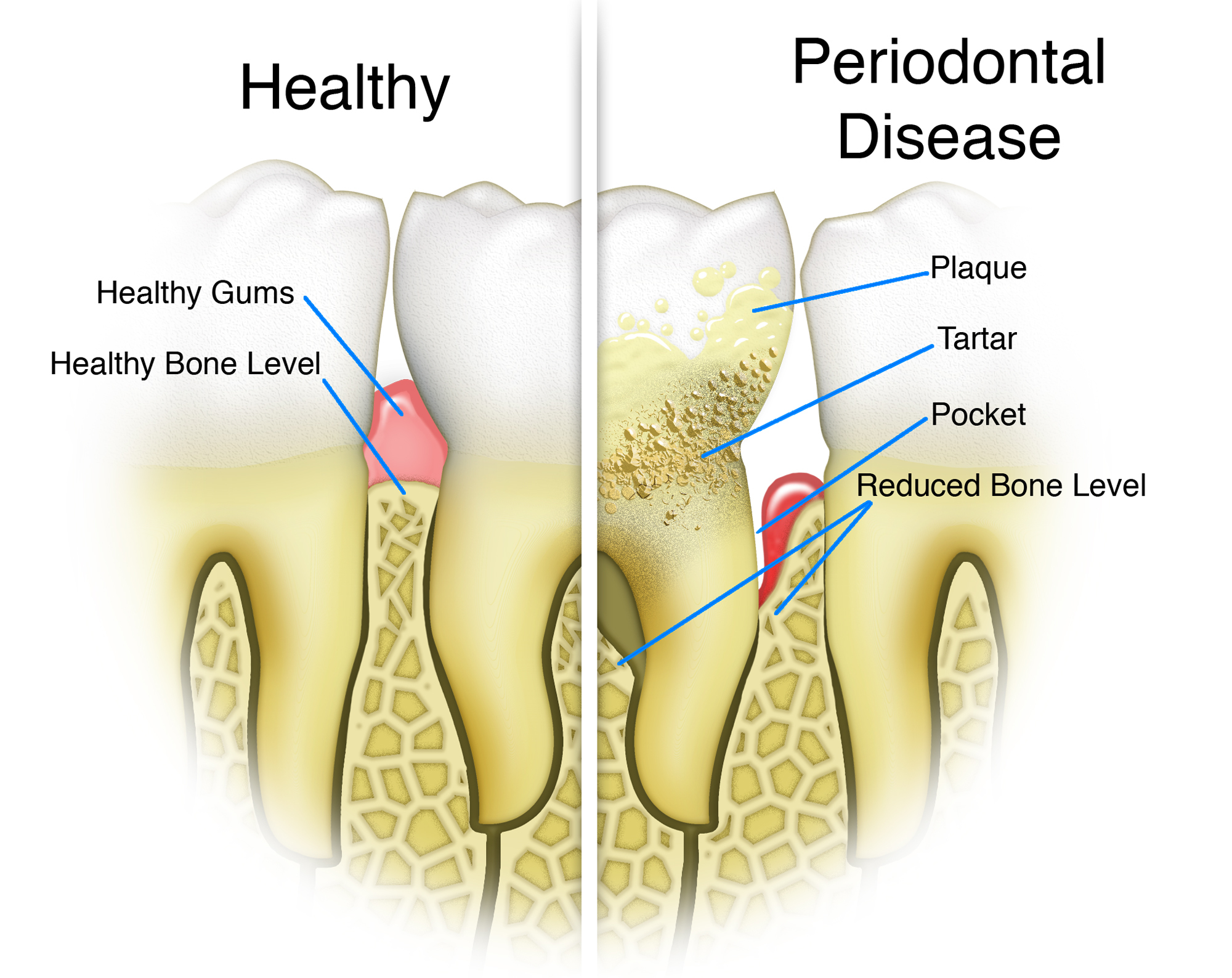 Kenneth R Levine DDS Periodontist - IN EUROPE DURING the Middle Ages ...