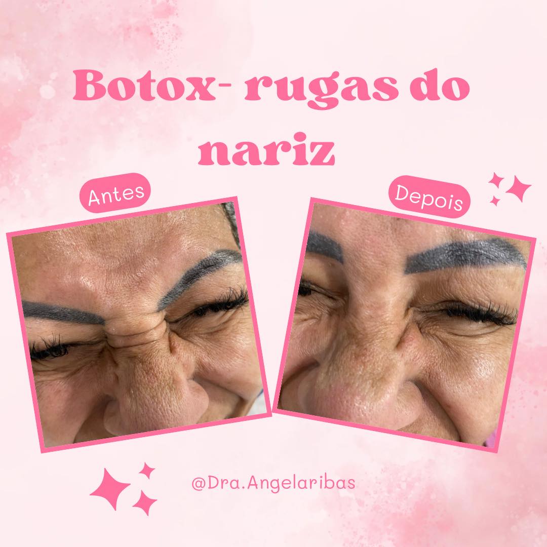 Dra. Ângela Ribas-Fisioterapia e Estética | Tijucas SC