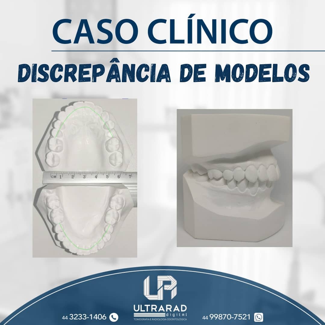 🔷... - Ultrarad - Radiologia Odontológica Digital