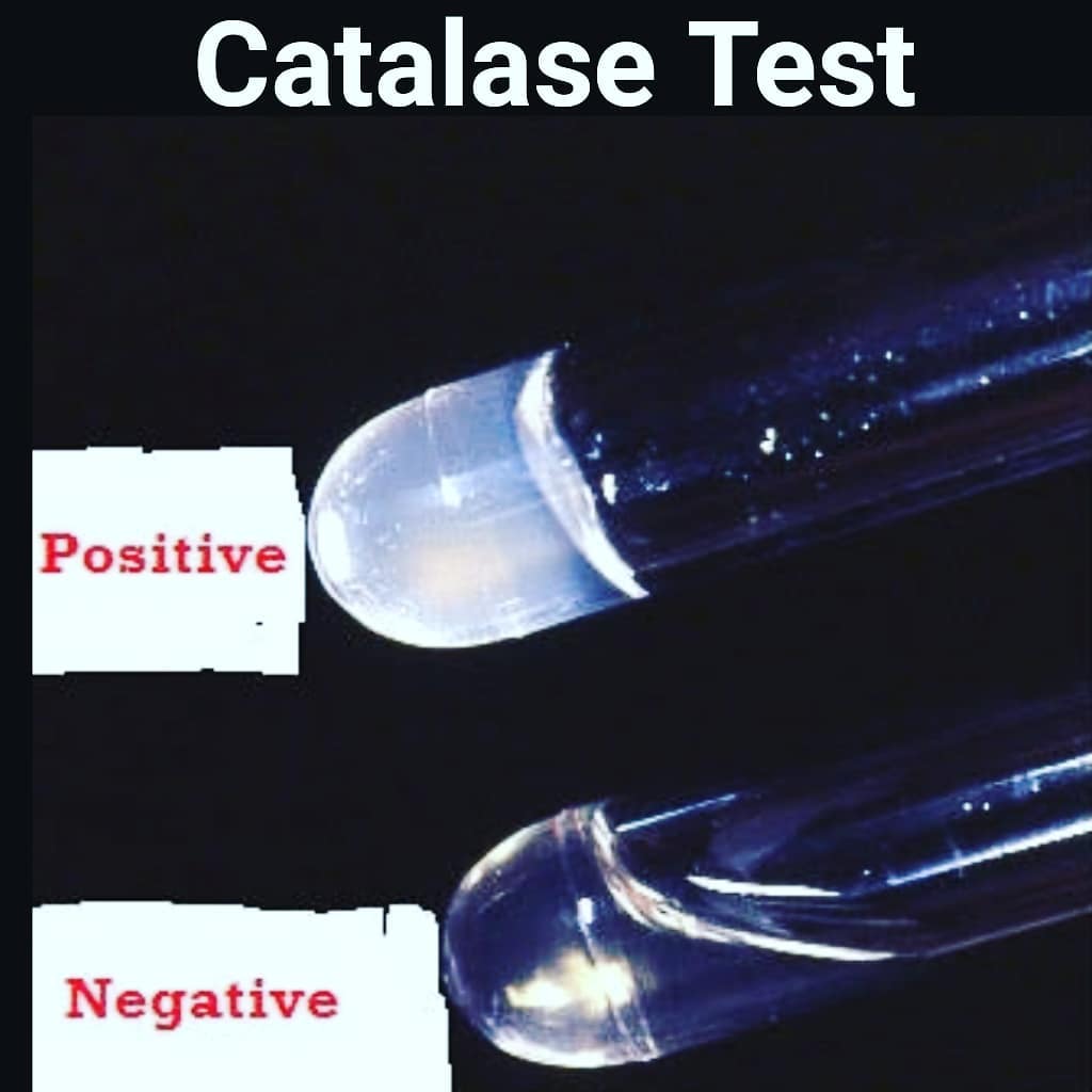 Catalase Test. . .. . . . . . . . .... - Microbiology Notes