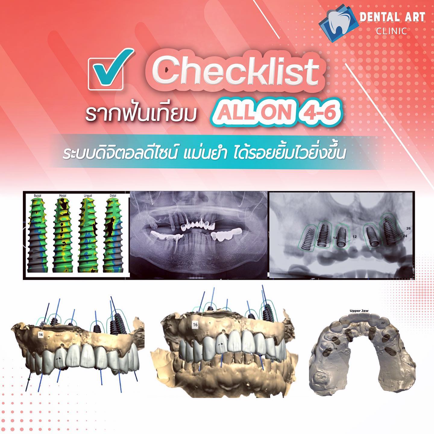 Dental Art Elite ทำฟัน จัดฟัน Invisalign วีเนียร์ รากฟันเทียม - Check ...