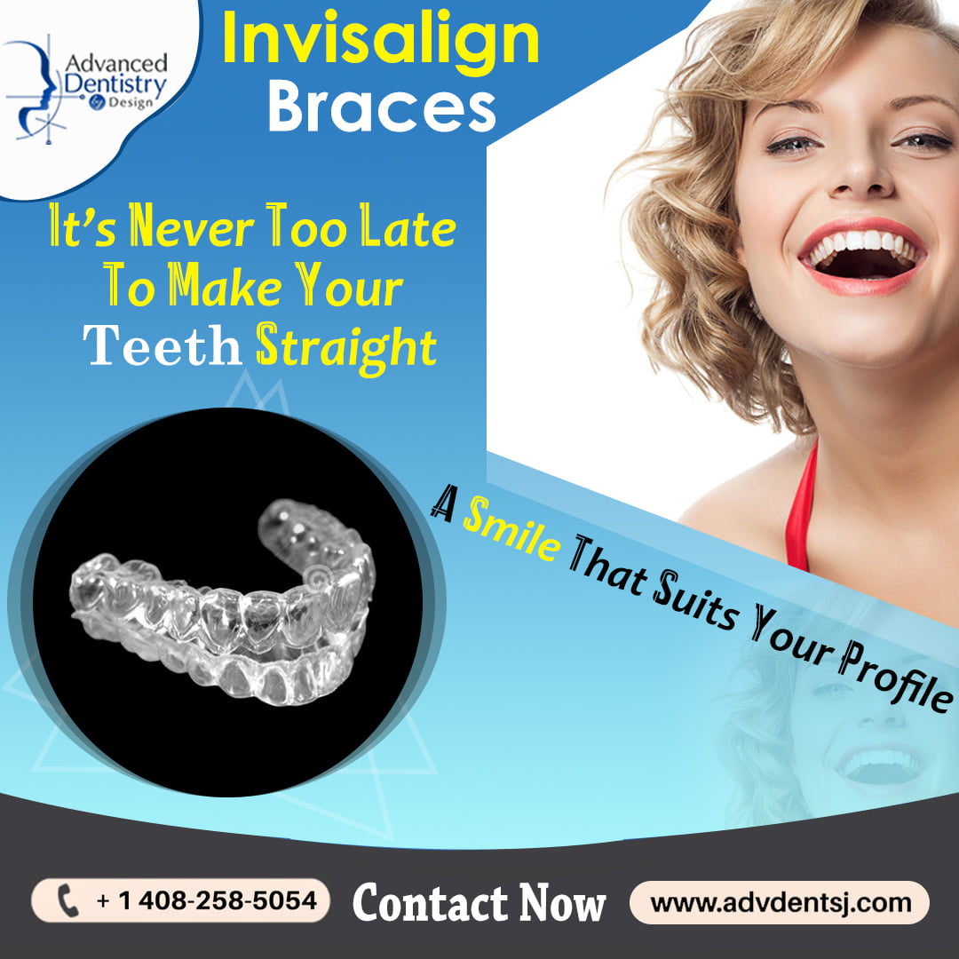 What is hampering your smile? With Invisalign braces you can achieve a ...