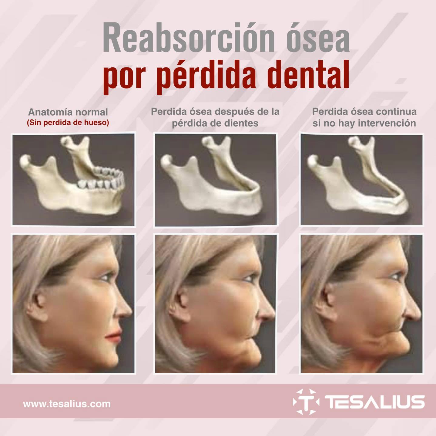 Dental Nepantla Koh | Guadalajara