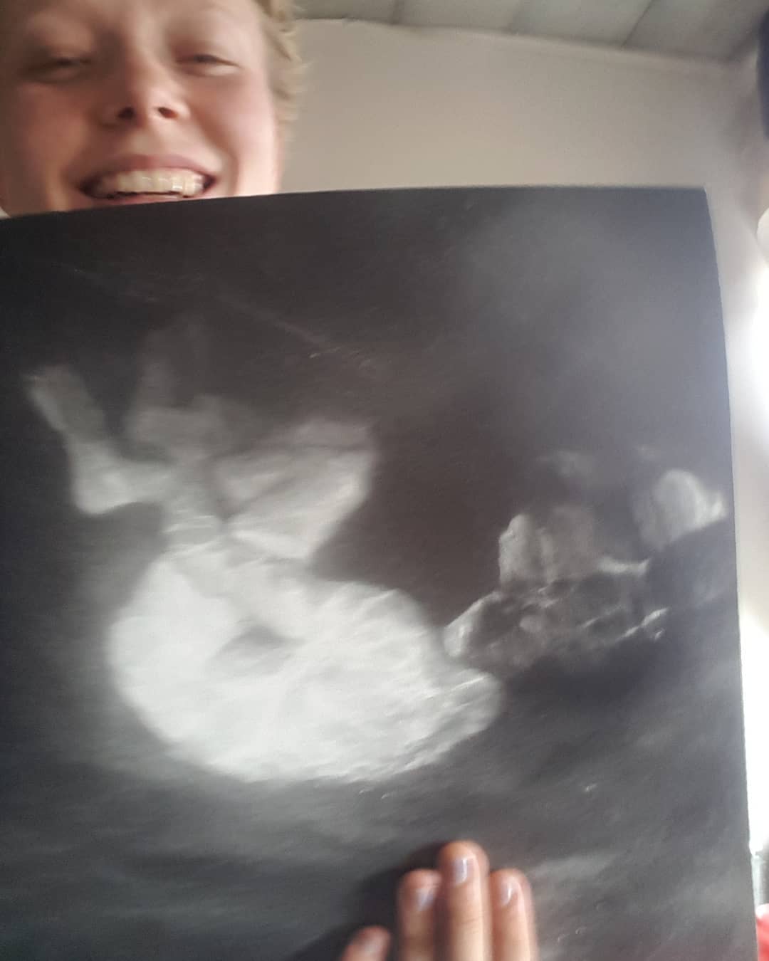 Alice - 1 week until 'Glow' is out ! the vinyl just arrived & now