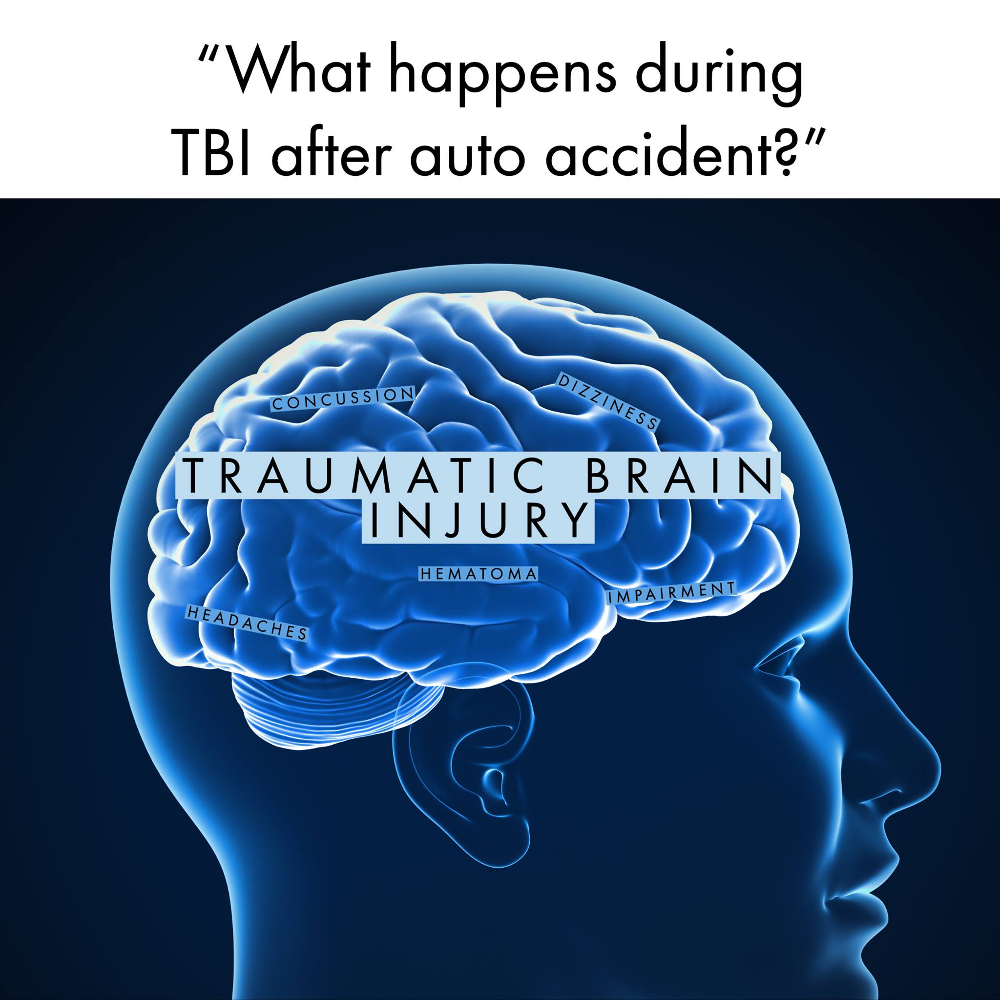 The anatomy of a... - Shaked Law Personal Injury Lawyers