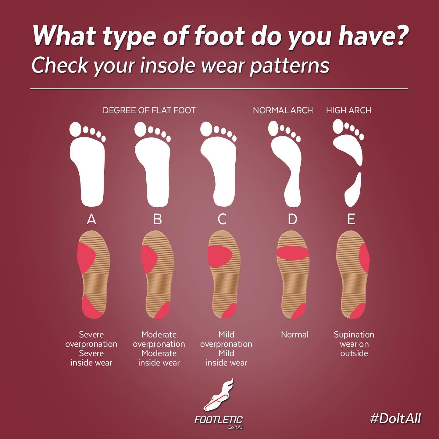 Footletic - Did you know that the wear patterns on your insoles can ...