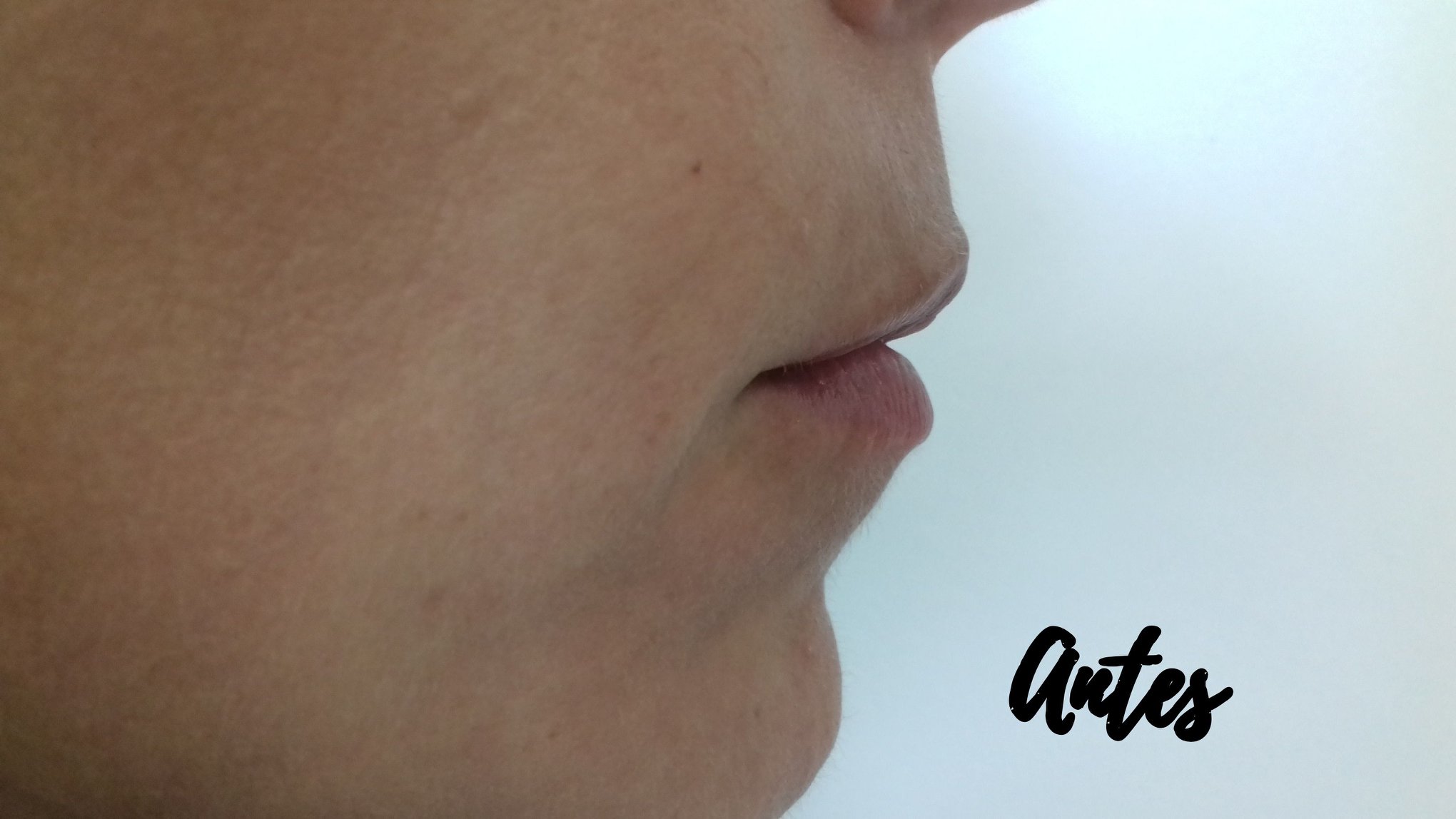 Medicina Estética de la piel | San Juan de la Rambla