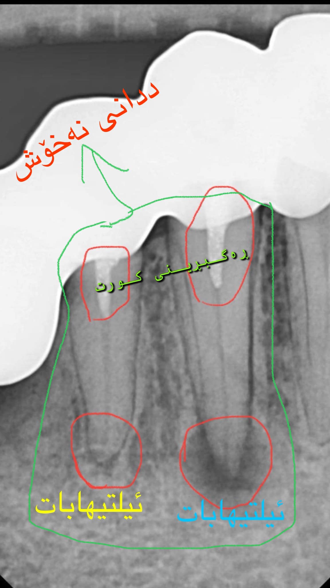 Oral health تەندروستی دەم و ددان | Malmö
