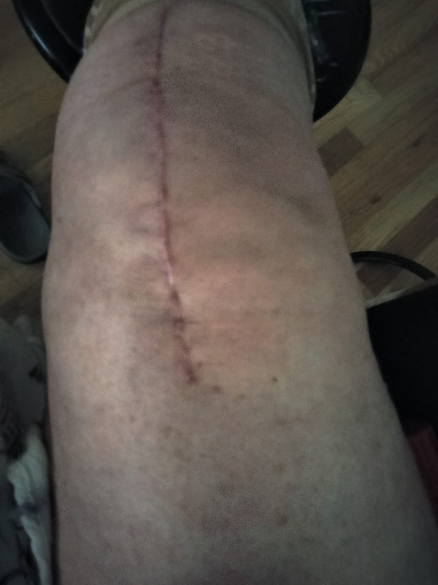 膝を診る目 - The Knee Up Close 膝を診る目 - The Knee Up Close How