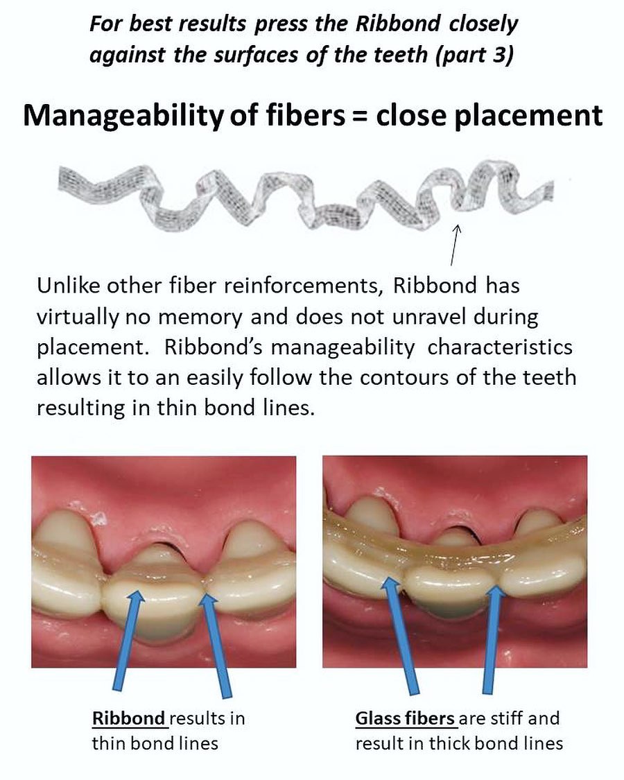 牙科界的愛因斯坦 Dr. RUDO小教室 RIBBOND =... - 杏昌生技Oral Medicine | Facebook