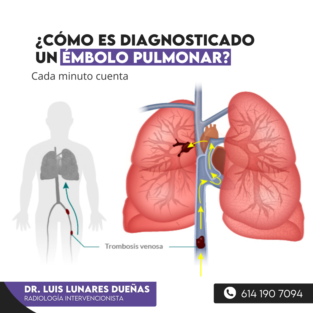 Dr. Luis Lunares Dueñas - Radiólogo Intervencionista - ¿Cómo se ...
