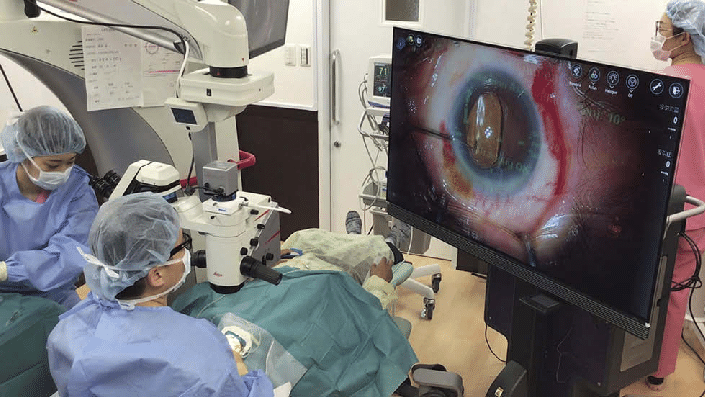 CIRUGÍA DE CATARATA,... - Clínica de Ojos Oftalmic Laser