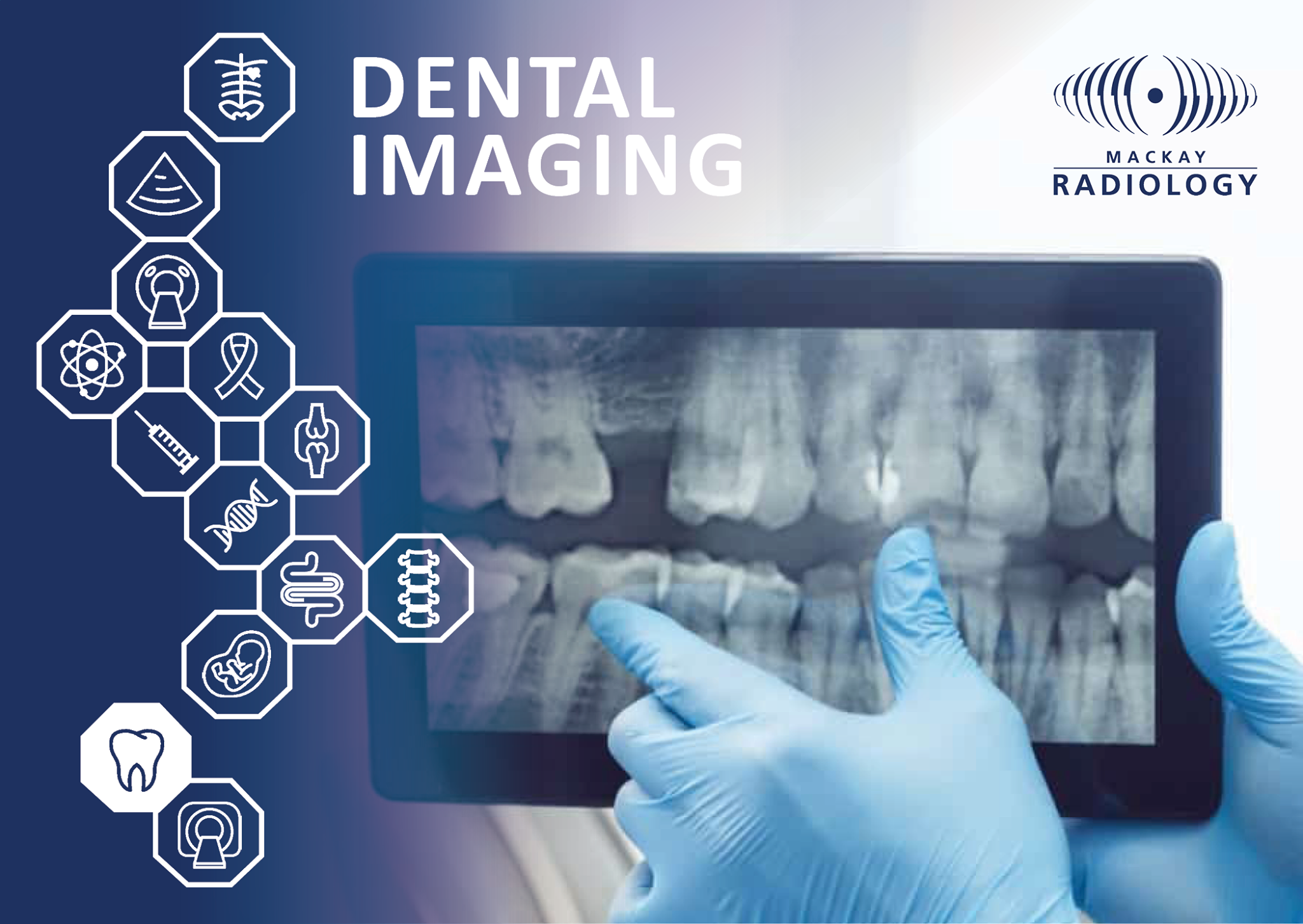 Dental Imaging - OPG (Orthopantomogram)... - Mackay Radiology