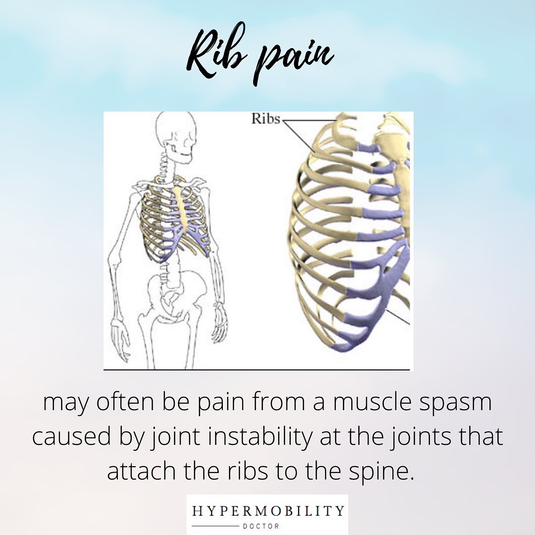 #HSD #EDS #hEDS #hypermobility... - Hypermobility Doctor | Facebook