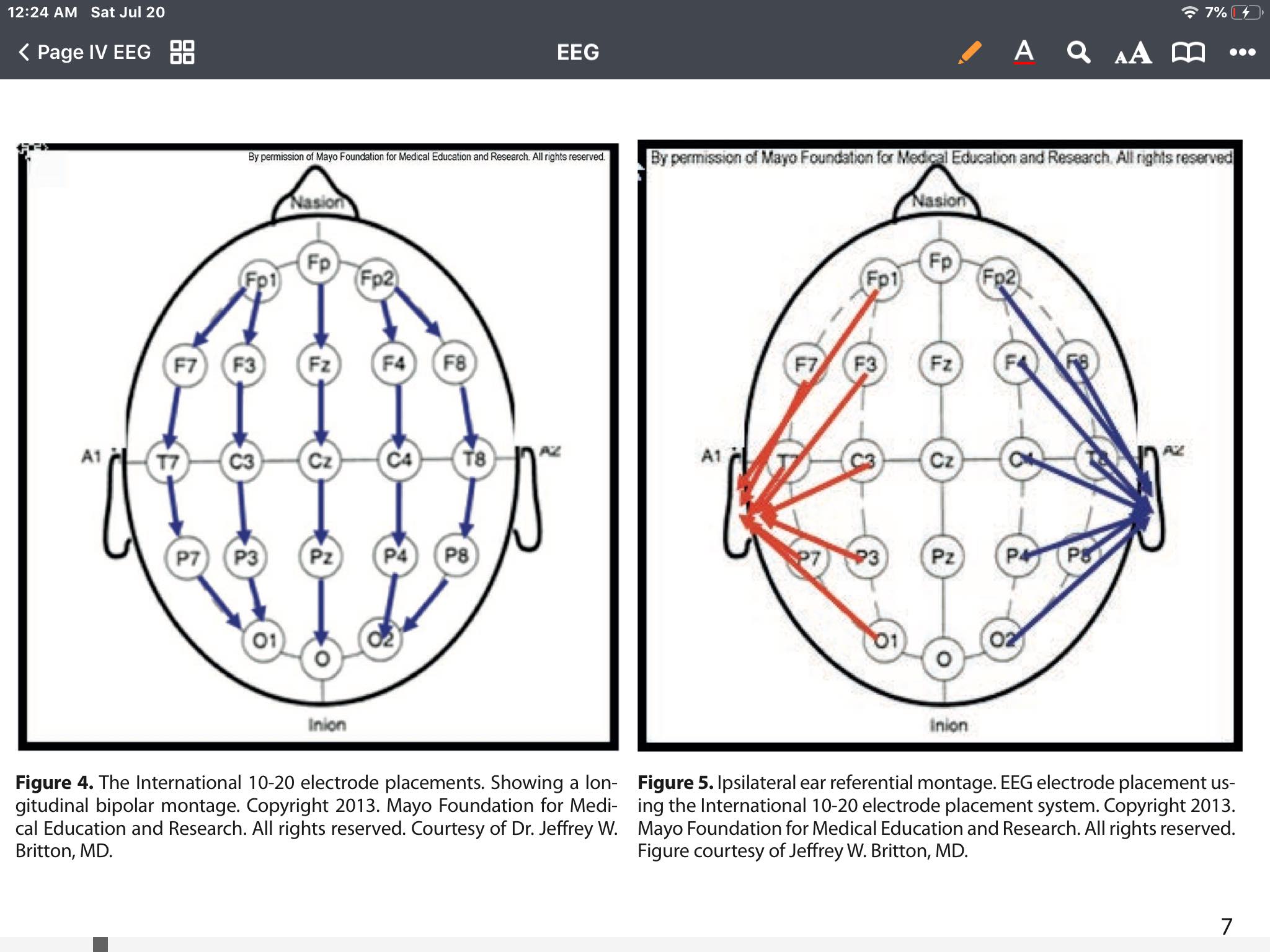 Figure 4. The International 10-20 electrode placements. Showing a