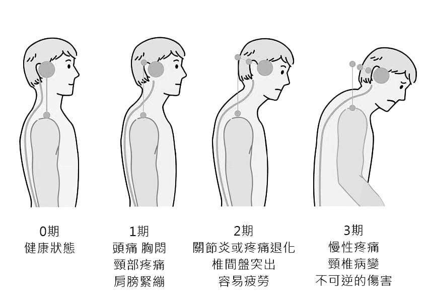 Top Bone Alignment and Treatment... - Kung Fu Tit Tar 功夫铁打 | Facebook