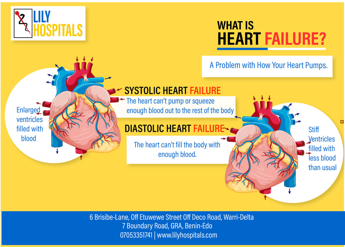 Lily Hospitals, Limited - Systolic Or Diastolic Heart Failure Heart ...