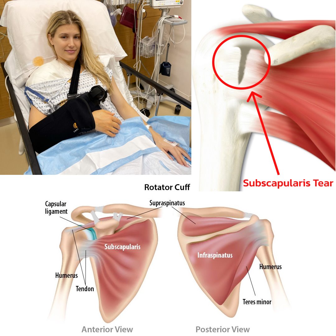KinectMD - Canadian tennis star Eugenie Bouchard announced that she has ...