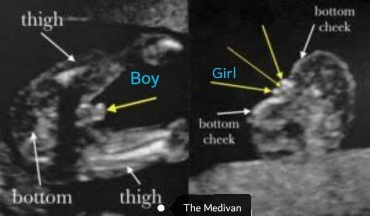 The Medivan - Obstetric Ultrasound is a key tool for analyzing the ...