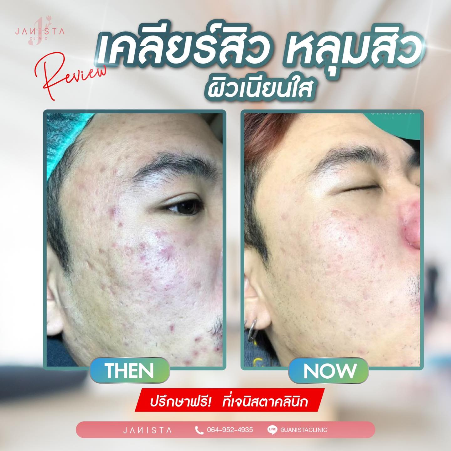 ︎... - เจนิสต้าคลินิก สาขาเชียงใหม่ - Janista Clinic | Facebook
