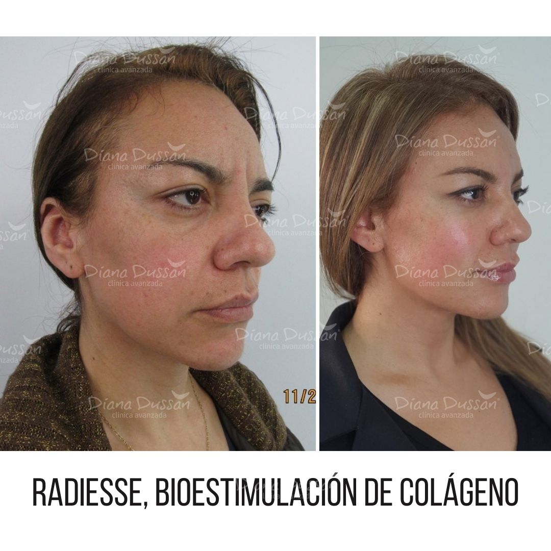 Pero 😱 ¿qué aplicaciones y en que... - Clinica Diana Dussan