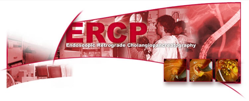 ERCP - Endoscopic Retrograde Cholangiopancreatogram