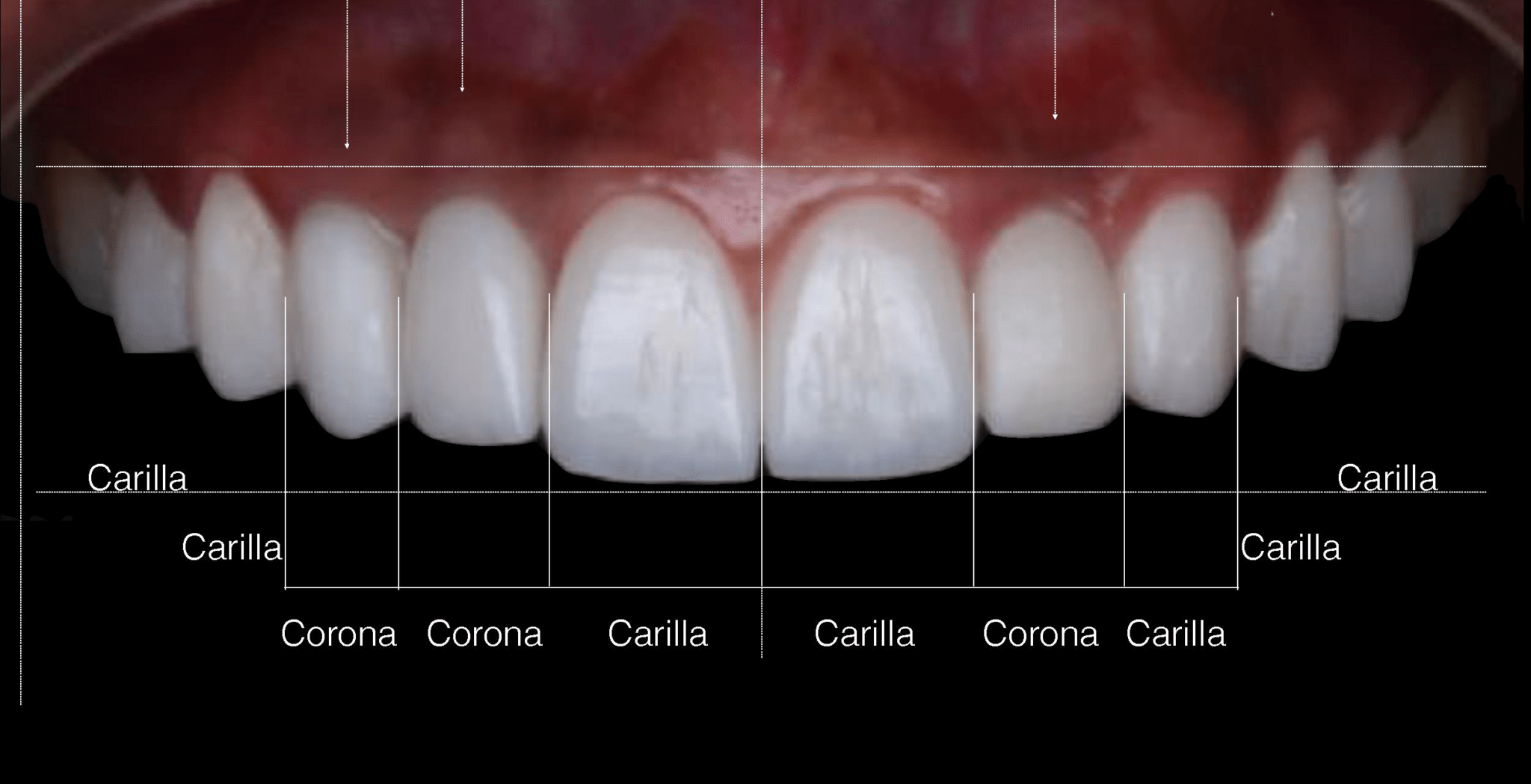 Dental Crima | Trujillo