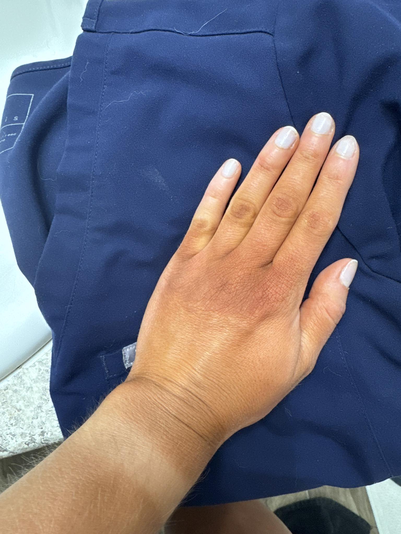 How to fix orange hands and palms after spray tan?