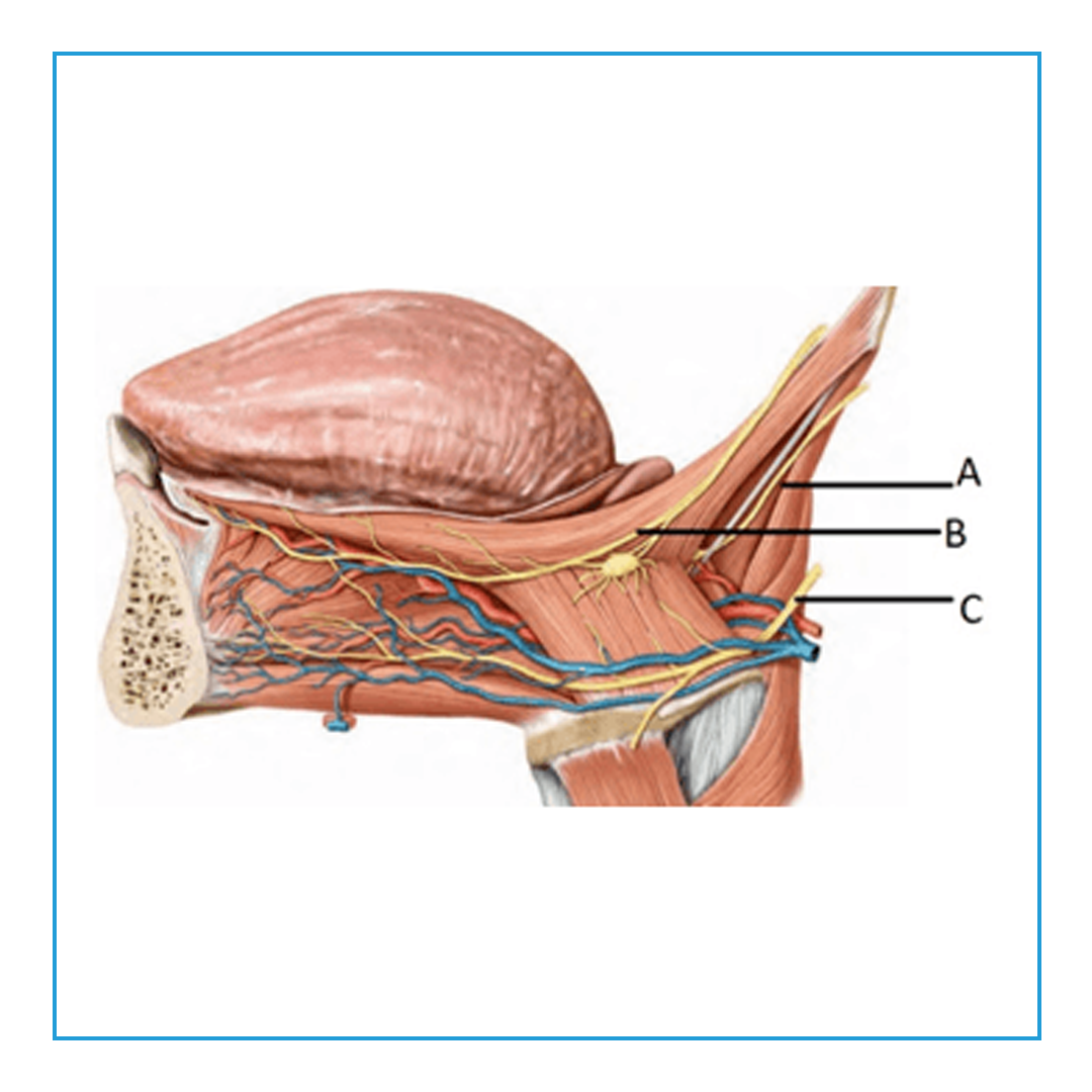 Identify the marked structure in the... - PrepLadder Medical